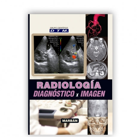 Radiología Diagnóstico x Imagen-UNIVERSAL 16.04-UNIVERSAL BOOKS-UNIVERSAL BOOKS