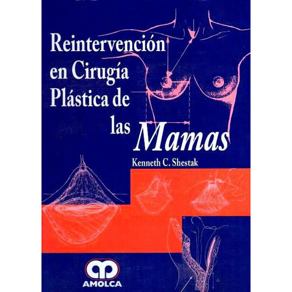 Reintervención en cirugía plástica de las mamas-REVISION - 27/01-AMOLCA-UNIVERSAL BOOKS
