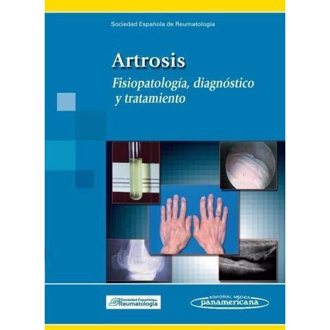 Artrosis Fisiopatologia, Diagnostico y Tratamiento-panamericana-UNIVERSAL BOOKS