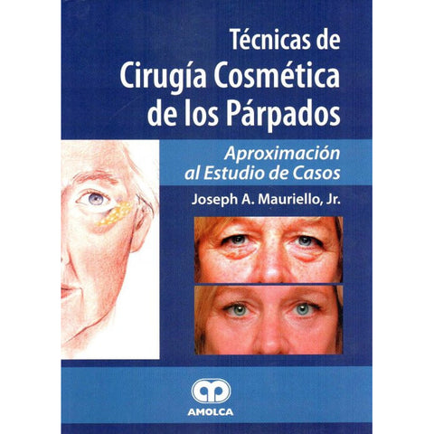 Técnicas de Cirugía Cosmética de los Párpados Aproximación al Estudio de Casos-REVISION - 26/01-AMOLCA-UNIVERSAL BOOKS