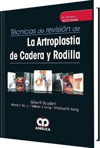 Técnicas de Revisión de la Artroplastia de Cadera y Rodilla-UNIVERSAL BOOKS-UNIVERSAL BOOKS