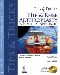 Tips and Tricks in Hip and Knee Arthroplasty-UNIVERSAL 28.03-UNIVERSAL BOOKS-UNIVERSAL BOOKS