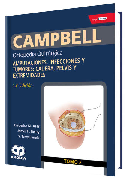 Ortopedia Quirurgica: Amputaciones, infecciones y tumores: Cadera pelvis y Extremidades Tomo 2-UNIVERSAL BOOKS-UNIVERSAL BOOKS