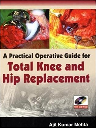 A practical Operative Guide for Total Knee and Hip Replacement-jayppe-UNIVERSAL BOOKS
