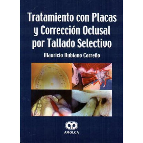 Tratamiento con placas y corrección oclusal por tallado selectivo-REVISION - 25/01-AMOLCA-UNIVERSAL BOOKS