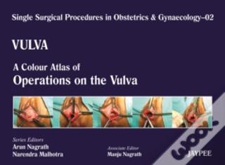 Single Surgical Procedures In Obstetrics And Gynaecology - Volume 2 - Vulva - A Colour Atlas Of Operations On The Vulva-UNIVERSAL 02.04-UNIVERSAL BOOKS-UNIVERSAL BOOKS