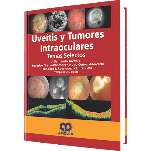 Uveitis y Tumores Intraoculares-amolca-UNIVERSAL BOOKS