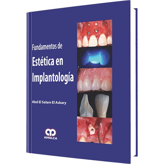 Fundamentos de Estetica en Implantologia-amolca-UNIVERSAL BOOKS