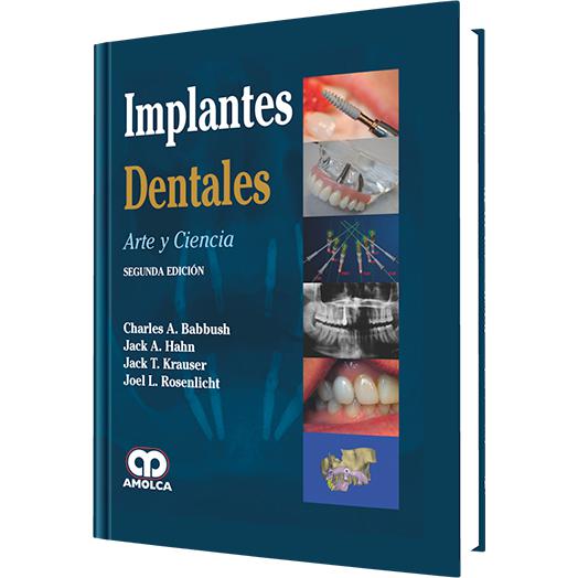 Implantes Dentales - Arte y Ciencia-amolca-UNIVERSAL BOOKS