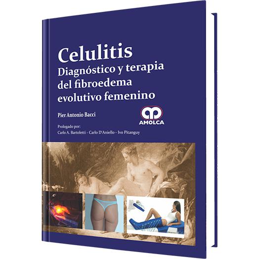 Celulitis Diagnostico y terapia del fibroedema evolutivo femenino-REVISION - 23/01-amolca-UNIVERSAL BOOKS