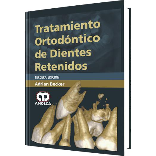 Tratamiento Ortodontico de Dientes Retenidos-amolca-UNIVERSAL BOOKS