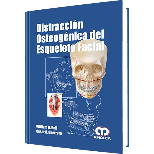Distraccion Osteogenica de Esqueleto Facial-amolca-UNIVERSAL BOOKS