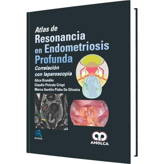 Atlas de Resonancia en Endometriosis Profunda - Correlacion-REVISION - 20/01-amolca-UNIVERSAL BOOKS