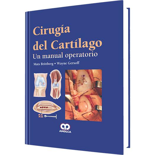 Cirugia del Cartilago un Manual Operatorio-REVISION - 24/01-amolca-UNIVERSAL BOOKS
