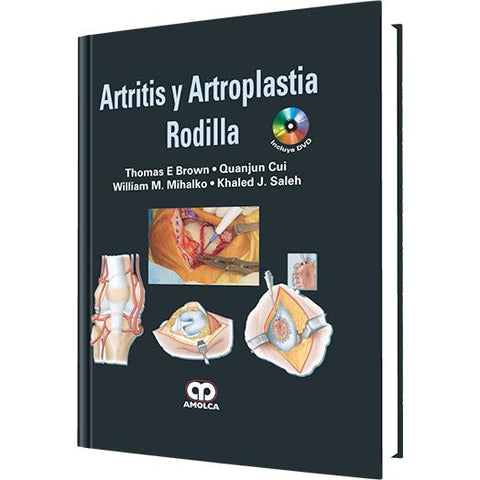 Artritis y Artroplastia de Rodilla-amolca-UNIVERSAL BOOKS