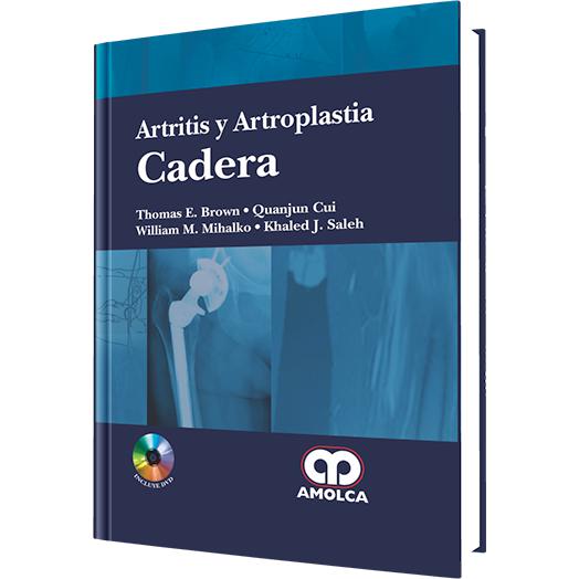 Artritis y Artroplastia de Cadera-REVISION - 23/01-amolca-UNIVERSAL BOOKS