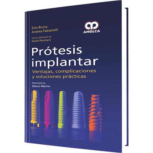 Protesis Implantar Ventajas, complicaciones y soluciones practicas-REVISION - 27/01-amolca-UNIVERSAL BOOKS