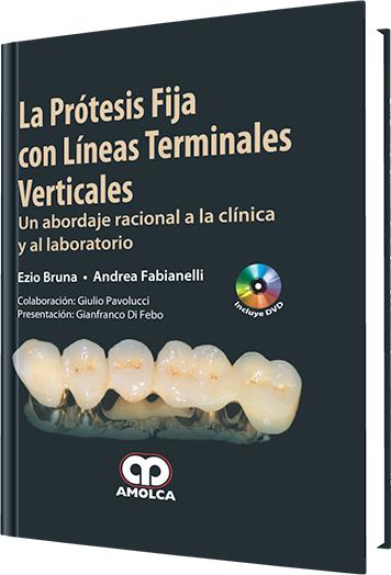 Protesis Fija con Lineas Verticales-amolca-UNIVERSAL BOOKS
