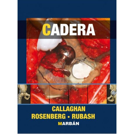 CADERA 1 VOL. T.D.-MARBAN-UNIVERSAL BOOKS
