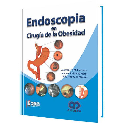 Endoscopia en Cirugia de la Obesidad-amolca-UNIVERSAL BOOKS