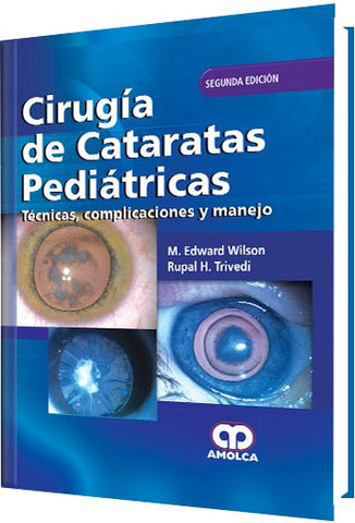 Cirugía de Cataratas Pediátricas – Técnicas, complicaciones y manejo – Segunda edición-UNIVERSAL BOOKS-UNIVERSAL BOOKS