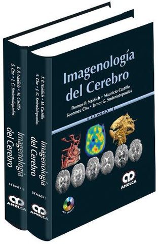 Imagenología del Cerebro-UNIVERSAL BOOKS-UNIVERSAL BOOKS