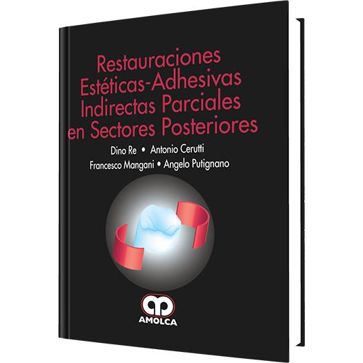 Restauraciones Esteticas - Adhesivas-REVISION - 26/01-amolca-UNIVERSAL BOOKS