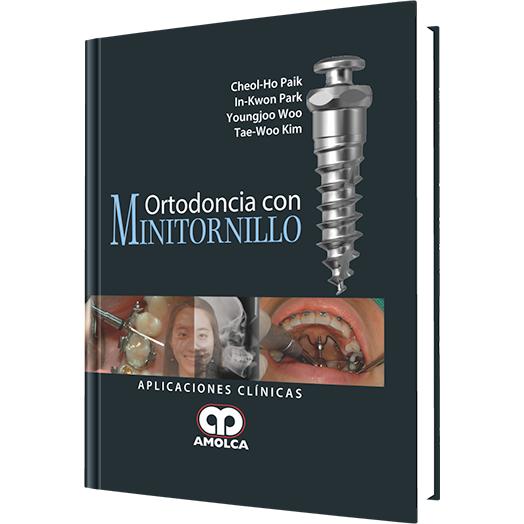 Ortodoncia con Minitornillo-amolca-UNIVERSAL BOOKS
