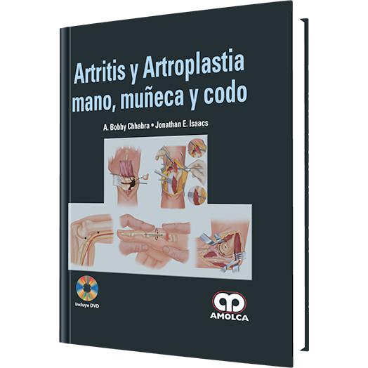 Artritis y Artroplastia - Mano, Muñeca y Codo-REVISION - 20/01-amolca-UNIVERSAL BOOKS