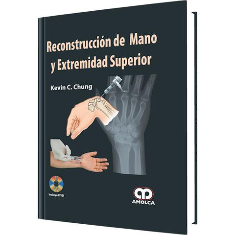 Reconstruccion de Mano y Extremidad Superior-REVISION - 27/01-amolca-UNIVERSAL BOOKS