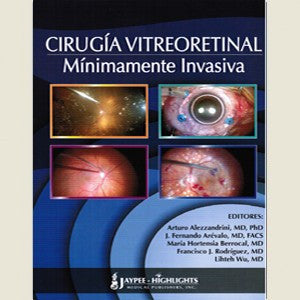 CIRUGIA VITREORETINAL MINIMAMENTE INVASIVA -Alezzandrini-REVISION - 24/01-jayppe-UNIVERSAL BOOKS