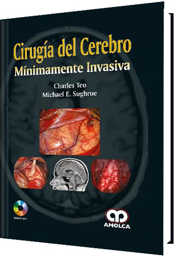 Cirugía del Cerebro Mínimamente Invasiva-UNIVERSAL BOOKS-UNIVERSAL BOOKS