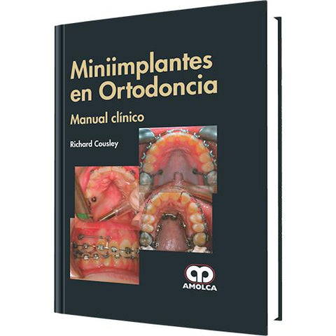 MiniImplantes en Ortodoncia, Manual Clinico-amolca-UNIVERSAL BOOKS