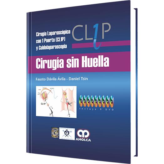 Cirugia sin Huella - Tecnicas Innovadoras de Cirugia Laparoscopica con un Puerto-REVISION - 24/01-amolca-UNIVERSAL BOOKS
