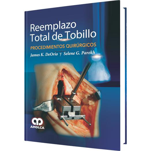 Reemplazo Total de Tobillo - Procedimientos quirurgicos-amolca-UNIVERSAL BOOKS