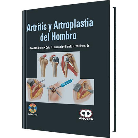 Artritis y Artroplastia del Hombro-REVISION - 20/01-amolca-UNIVERSAL BOOKS