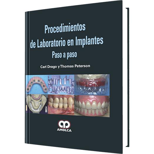 Procedimientos de Laboratorio en Implantes - Paso a Paso-REVISION - 27/01-amolca-UNIVERSAL BOOKS