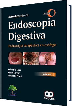 Actualización en Endoscopia Digestiva Endoscopia terapéutica en esófago SOBED Volumen 2-UNIVERSAL BOOKS-UNIVERSAL BOOKS