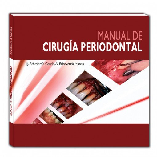 Manual de Cirugia Periodontal-ergon-UNIVERSAL BOOKS