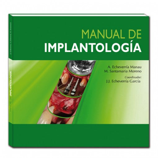 Manual de implantologia-ergon-UNIVERSAL BOOKS