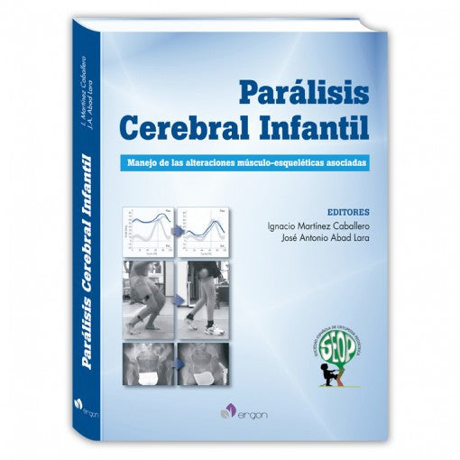 Paralisis cerebral infantil. Manejo de las alteraciones musculo-esqueleticas asociadas-ergon-UNIVERSAL BOOKS