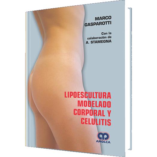 Lipoescultura, Modelado Corporal y Celulitis-amolca-UNIVERSAL BOOKS
