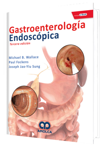 Gastroenterologia Endoscópica 3 Edicion