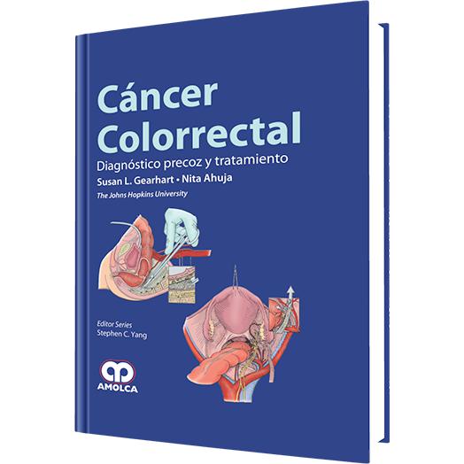 Cancer Colorrectal Diagnostico Precoz y Tratamiento-amolca-UNIVERSAL BOOKS