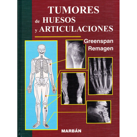 Tumores de Huesos y Articulaciones-REVISION - 25/01-MARBAN-UNIVERSAL BOOKS