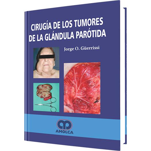 Cirugia de los Tumores de la Glandula Parotida-amolca-UNIVERSAL BOOKS