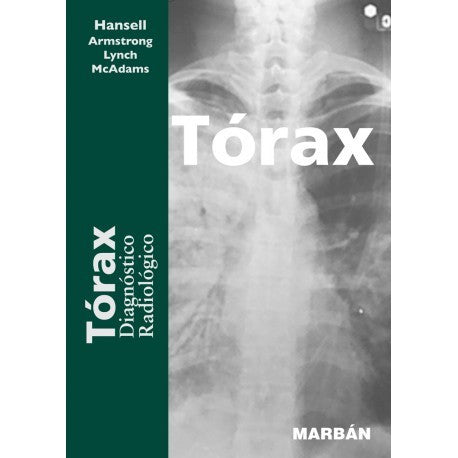 TORAX - Diagnostico Radiologico-REVISION - 25/01-MARBAN-UNIVERSAL BOOKS