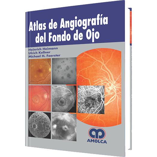 Atlas Angiografia Fondo de Ojo-amolca-UNIVERSAL BOOKS