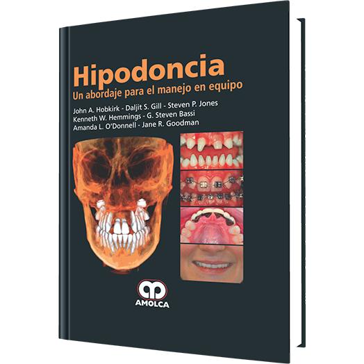 Hipodoncia Un Abordaje para el Manejo en Equipo-amolca-UNIVERSAL BOOKS