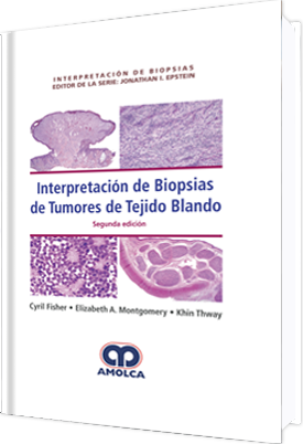 INTERPRETACION DE BIOPSIAS. INTERPRETACION DE BIOPSIAS DE TUMORES DEL TEJIDO BLANDO-UNIVERSAL BOOKS-UNIVERSAL BOOKS